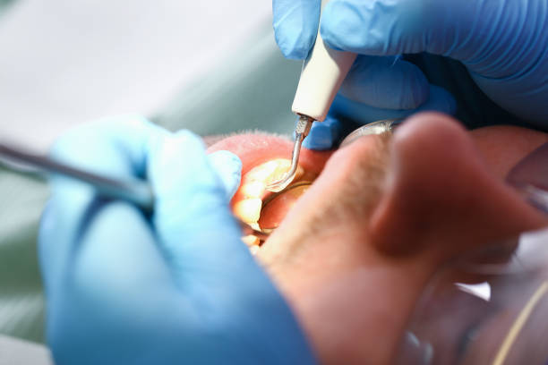 Best Emergency Dentist for Lost Fillings or Crowns in Sherwood, OH