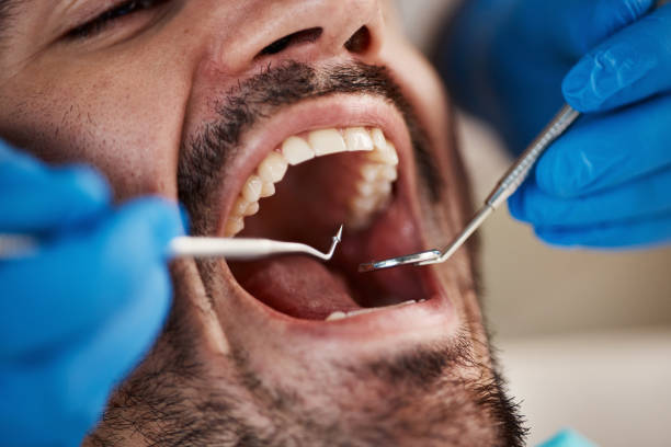 Best Weekend Emergency Dentist in Sherwood, OH
